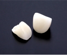 セラミック矯正