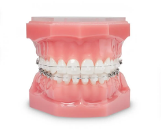 一般的な矯正治療