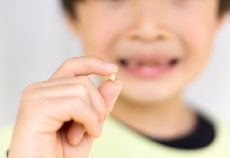 欠けた歯/割れた歯の治療