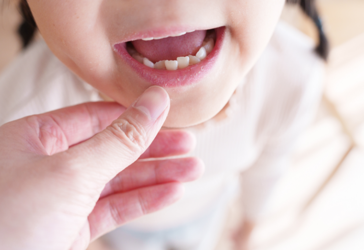 子どもの歯並びが気になる方へ