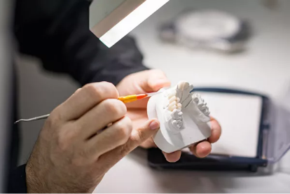 歯科技工士との連携でスムーズな仕上がり