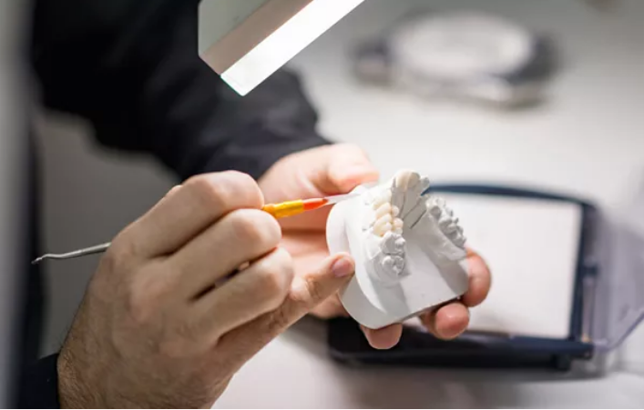 専属の歯科技工士