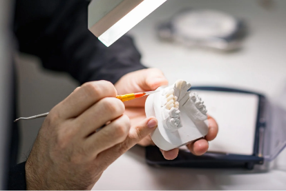 「歯科技工士」との綿密な連携