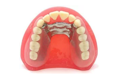 ノンクラスプデンチャー＋金属床