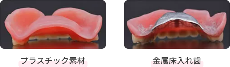 金属床の入れ歯