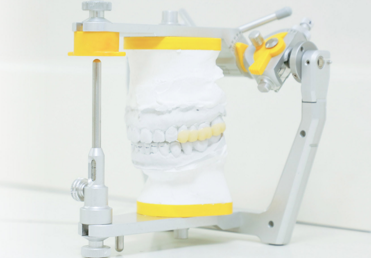 ALBA歯科&矯正歯科の顎関節症治療