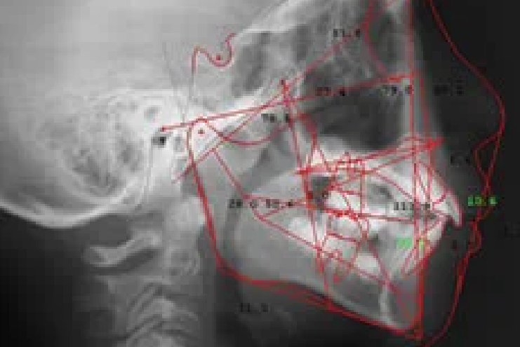 精密機器で治療の精度を高める