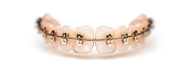 一般的な小児矯正