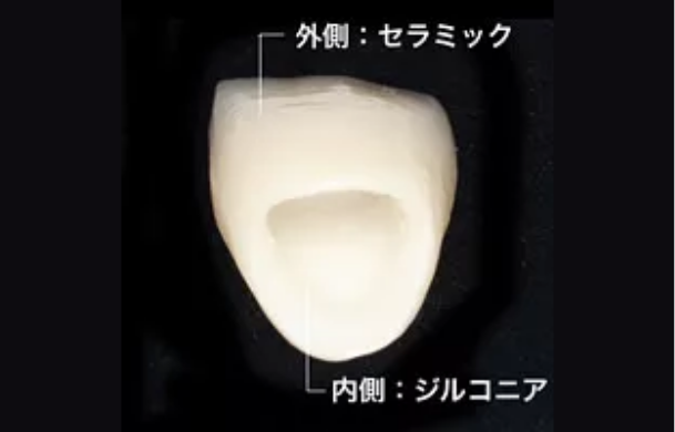 ジルコニアセラミック