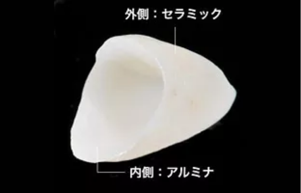 オールセラミック