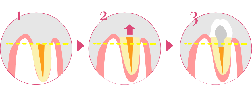 ALBA歯科&矯正歯科の治療方法