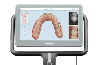 治療後の仕上がりを事前にシミュレーション