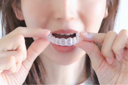 取り外しができる