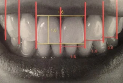 ゴールデンプロポーション