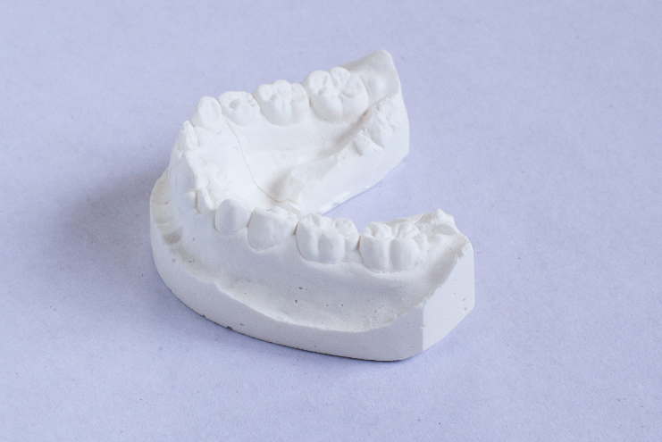 セットアップ模型を活用